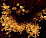 Geographic Origin Plays Key Role in Tuberculosis Infection, Harvard Study Finds