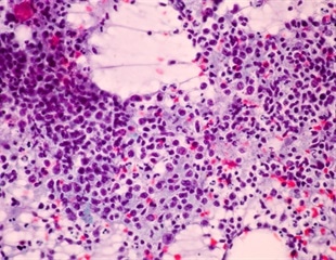 Peat Bog Fungi as a Reservoir of Anti-Tuberculosis Compounds
