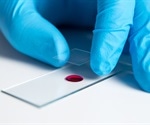 Study shows how individualization with pharmacogenomics could impact COVID-19 treatments