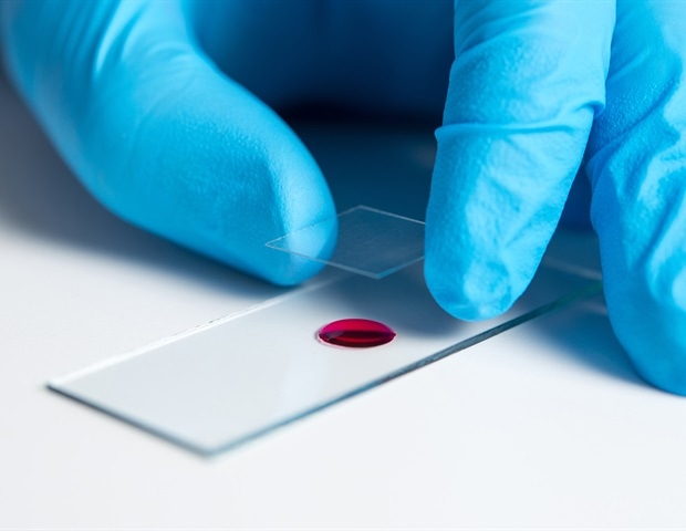 Scientists Reconstruct a 700-Million-Year Evolutionary Tree of Blood Cells