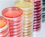 Investigating the Link Between Metabolism and Intestinal Development