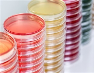 Investigating the Link Between Metabolism and Intestinal Development