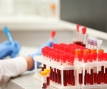 Scientists reveal health benefits of clonal hematopoiesis in allogeneic transplants