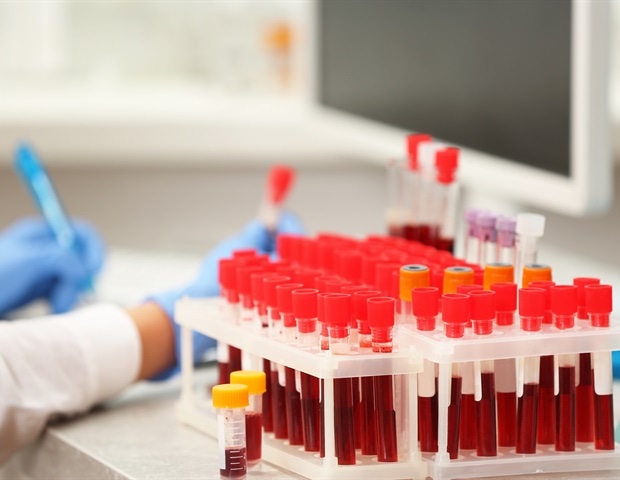 Scientists Reconstruct a 700-Million-Year Evolutionary Tree of Blood Cells