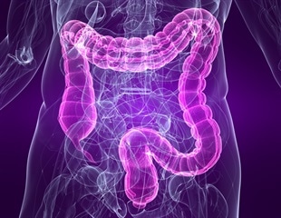 Machine learning algorithm helps differentiate benign and premalignant colorectal polyps