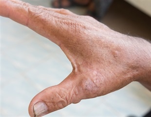 Maternal And Fetal Cell Exchange Shapes Health Across Multiple Generations