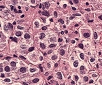 Innovative AI Software Automates Complex Microscopy Image Segmentation Tasks