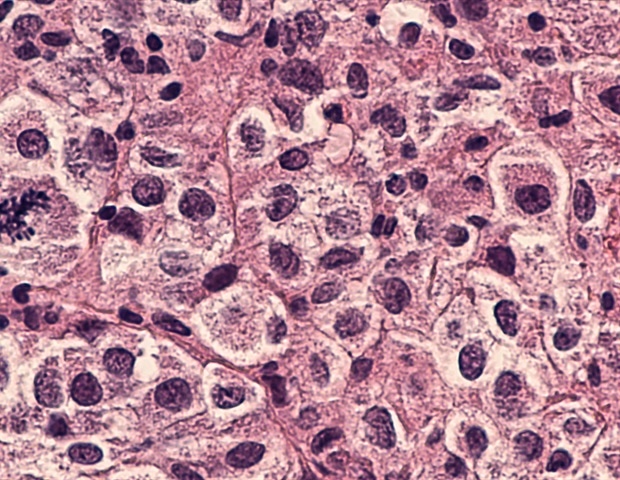 New Stem Cell Reports Perspective: Biomanufacturing in Low Earth Orbit