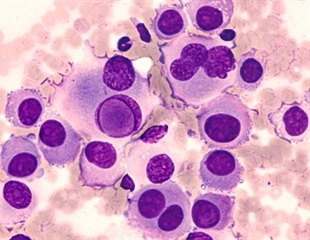 How the Disturbed Recycling Chain of Endoplasmic Reticulum Causes Neurodegenerative Diseases