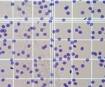 Adaptive Microfluidic Channel Enhances Impedance Flow Cytometry Sensitivity