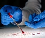 Researchers propose replacing ancestry in forensics with a population structure approach