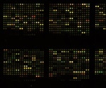 Novel Microfluidic Device for Rapid Plant Stress Diagnosis via miRNA Detection