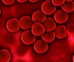 Study finds how the malaria parasite can withstand fever's heat