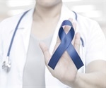 Loss of SOX9 Gene Linked to Aggressive Colorectal Cancer