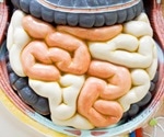 Common Food Additives may Have Negative Effects on Your Gut Health