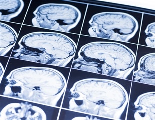 Scientists Reveal Brain Activity Dynamics During Male Sexual Behavior
