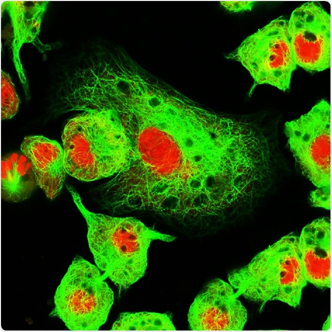 Real fluorescence microscopic view of human neuroblastoma cells. Image Credit: Vshivkova / Shutterstock