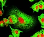 Photobleaching in Fluorescence Microscopy