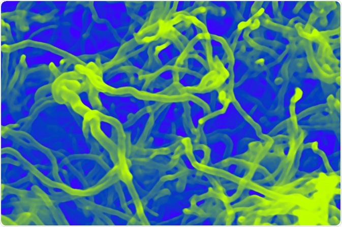 Nanotubes bundles viewed through an electron microscope. Image Credit: Dimarion / Shutterstock
