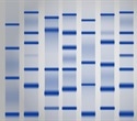 New RNA Extraction Approaches Overcome Agarose Barriers in Lung Slices