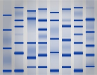 New RNA Extraction Approaches Overcome Agarose Barriers in Lung Slices