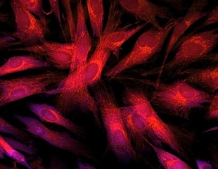 New Molecular Imaging Technology Illuminates Proteins Inside Living Cells