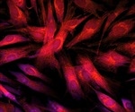 Novel lung phantom mimicking pulmonary optical properties may enable air volume assessment