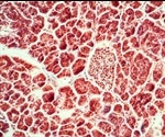 Insulin Signaling Pathway