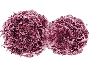 Presage Biosciences and AstraZeneca Partner to Advance Immuno-Oncology Research for Head and Neck Cancer