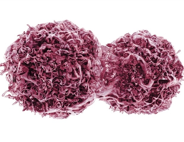 New Cellular Signature Reveals Why Some Prostate Cancers Resist Standard Treatment