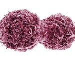 Strata Oncology publishes study validating integrative pan-solid tumor predictor of PD-1/PD-L1 blockade benefit