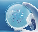 Uncovering How Cholera Evaded Phages For Epidemic Success