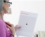 Newly Identified Rare Genetic Variants Could Point to One of the General Mechanisms Driving AMD