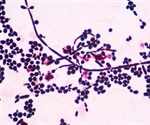Insights into the Formation of Nascent Membrane Structures in Yeast Sporulation