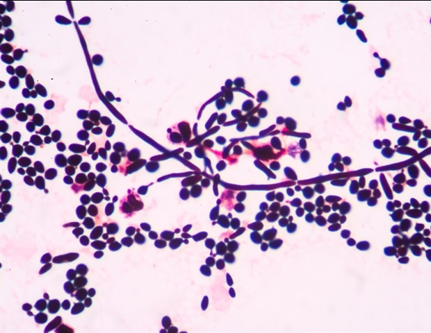 Fluctuating Environments Stabilize a Self-Destructive Survival Strategy in Yeast