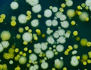 Gene Loss and Gain Shaped the Evolution of Relapsing Fever Bacteria