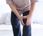 3D biomaterial helps implanted stem cells stick around to reverse arthritis