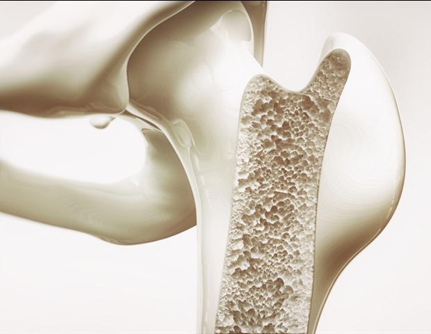 Global Breakthrough Maps Genes and Cells Regulating Bone Health