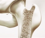 Spatial Transcriptomics Reshapes Musculoskeletal Research and Therapy