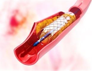 Synthetic Anti-Clotting Agent Derived from Bloodsucking Organisms Saliva