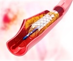 Synthetic Anti-Clotting Agent Derived from Bloodsucking Organisms Saliva