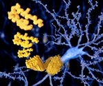 Nutritional supplement may reduce the risk of strokes caused by a rare genetic disorder
