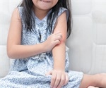 Exploring the Link Between Gut Health and Effective Milk Allergy Treatment