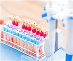 Ghost Cytometry - Revolutionizing Cell Sorting