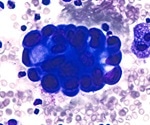 Study shows why a specific gene mutation has opposite effects on mice and human cancers