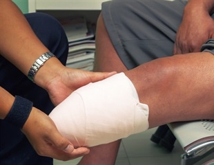 LSTM Scientists Discover Treatment for Tissue Damage by African Spitting Cobra Venom