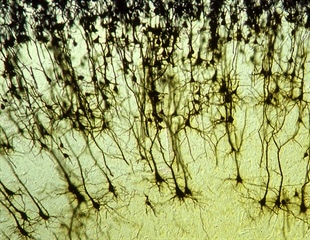 AI Tools Track and Identify Neurons in Moving Animals