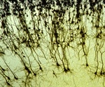Study Unveils Surprising Cause of Brain Cell Death in Huntington's Disease