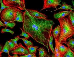 New Insights into How Mutant p53 Promotes Tumor Growth