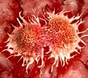Breakthrough Research Uncovers Dual Role of Enzymes in Prostate Cancer
